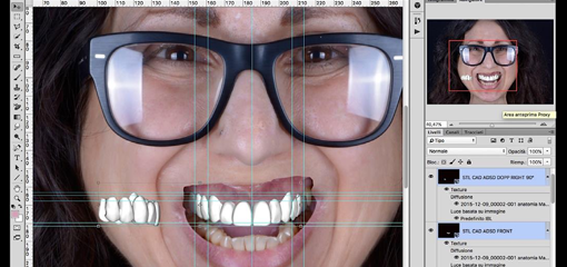 Эстетический цифровой дизайн улыбки (ЭЦДУ): визуальное 3D восприятие и пространственные морфологические показания. Часть 2 (из 2)
