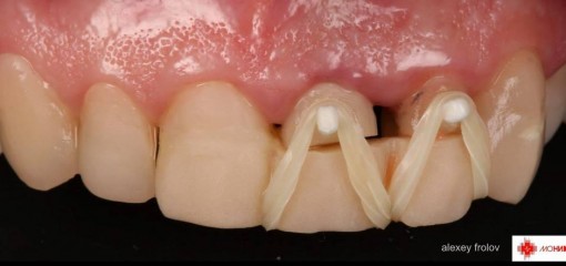 Малоинвазивные методы реабилитации на амбулаторном стоматологическом приеме