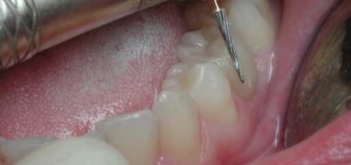 На пути к осознанию секретов индивидуальных форм зубов человека