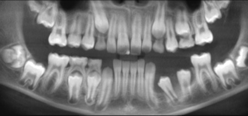 Обоснование применения конусно-лучевой компьютерной томографии в стоматологии