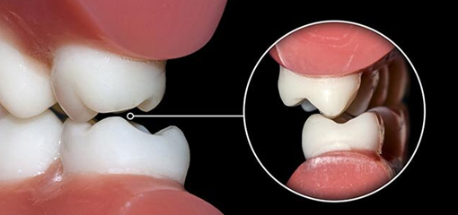 Концепции окклюзии в современной стоматологии. История, терминология, клиническое значение