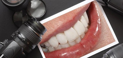 Что нужно фотографировать в повседневной практике врача-стоматолога?