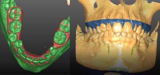 Новая концепция 4D виртуального планирования в стоматологии