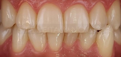 Будущее дентальной фотографии в стоматологии