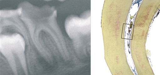 Реакция пульпы и периапикальных тканей на глубокий кариес в несформированных зубах: гистологическое и гистобактериологическое исследование