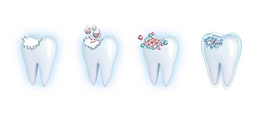 Алгоритм защиты твердых тканей зубов у ортодонтических пациентов