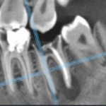 Обоснование применения конусно-лучевой компьютерной томографии в стоматологии