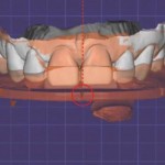 Цифровая лицевая дуга и дентолицевой анализатор: от 2D к 3D анализу улыбки