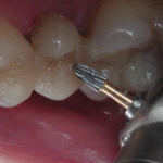 На пути к осознанию секретов индивидуальных форм зубов человека