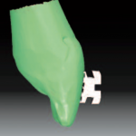 Применение конусно-лучевой компьютерной  томографии в ортодонтии