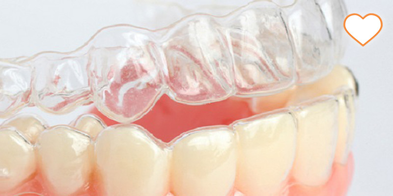 Коррекция улыбки с помощью элайнеров: максимальная эстетика и сохранение тканей зуба