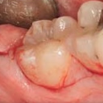Факторы риска и послеоперационное ведение пациентов в амбулаторной хирургической стоматологии