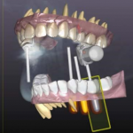 Новая концепция 4D виртуального планирования в стоматологии