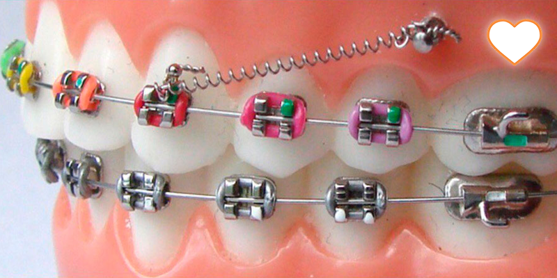 Комплексное планирование в ортодонтии