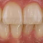 Будущее дентальной фотографии в стоматологии