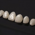 Изменение формы, ангуляции и цвета фронтальной группы зубов с помощью реставраций из прессованной керамики