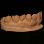 Разнообразие окклюзионных поверхностей зуба